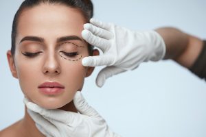 Eyelid Surgery Mt Vernon WA