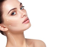 Woman in Mount Vernon with white lines superimposed over her face, showing facelift and neck lift concept